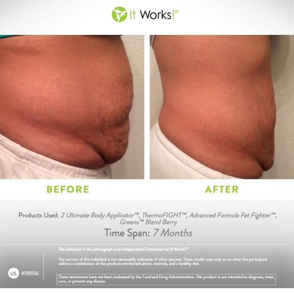 Meet your Posher, Elizabeth - Picture 2 of 4